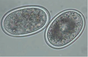 image of eggs of ascaridia galli
