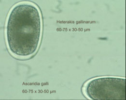 image of Parasite Eggs in smear